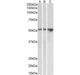 Western Blot - Anti-TIM 1 Antibody (A83529) - Antibodies.com