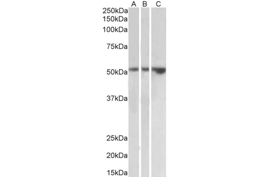 Western Blot - Anti-TIM 1 Antibody (A83529) - Antibodies.com