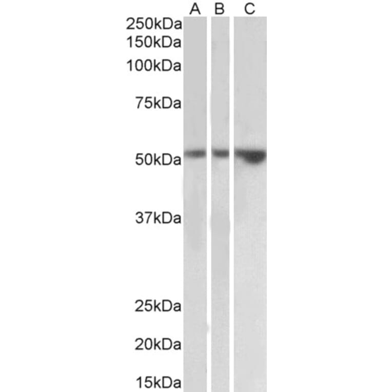Western Blot - Anti-TIM 1 Antibody (A83529) - Antibodies.com