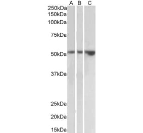 Western Blot - Anti-HAVCR1 Antibody (A83529) - Antibodies.com