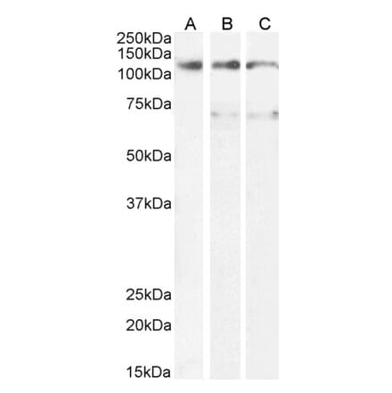 Western Blot - Anti-OSMR Antibody (A83531) - Antibodies.com