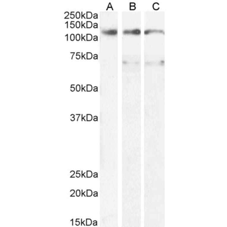 Western Blot - Anti-OSMR Antibody (A83531) - Antibodies.com