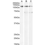 Western Blot - Anti-OSMR Antibody (A83531) - Antibodies.com