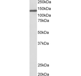 Western Blot - Anti-OSMR Antibody (A83531) - Antibodies.com