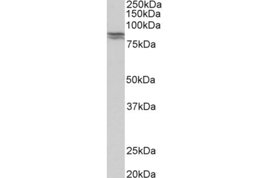 Western Blot - Anti-E Cadherin Antibody (A83532) - Antibodies.com
