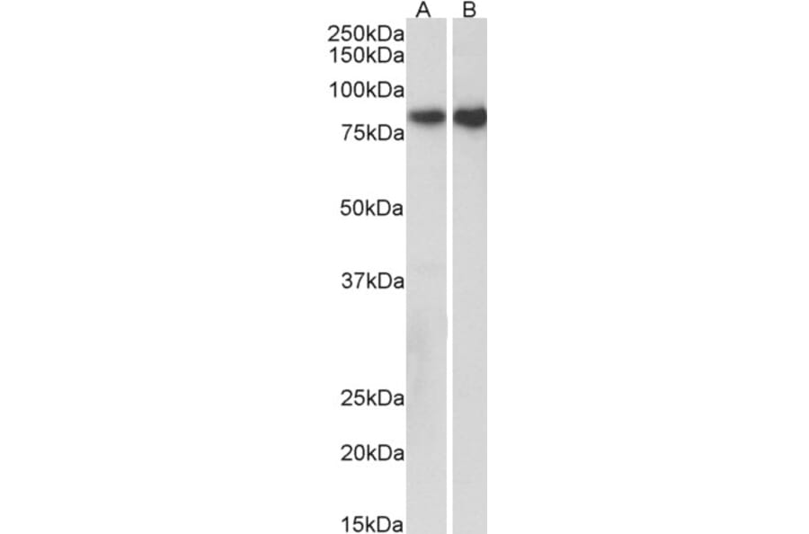 Western Blot - Anti-E Cadherin Antibody (A83532) - Antibodies.com