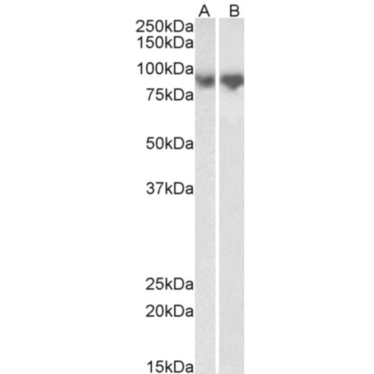 Western Blot - Anti-E Cadherin Antibody (A83532) - Antibodies.com