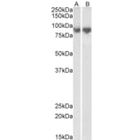 Western Blot - Anti-E Cadherin Antibody (A83532) - Antibodies.com