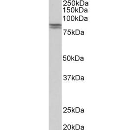 Western Blot - Anti-E Cadherin Antibody (A83532)