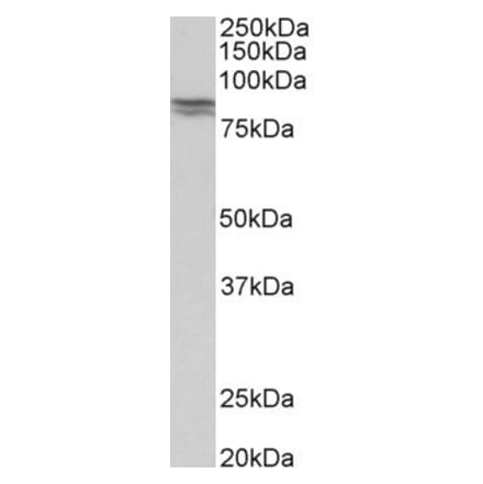 Western Blot - Anti-E Cadherin Antibody (A83532)