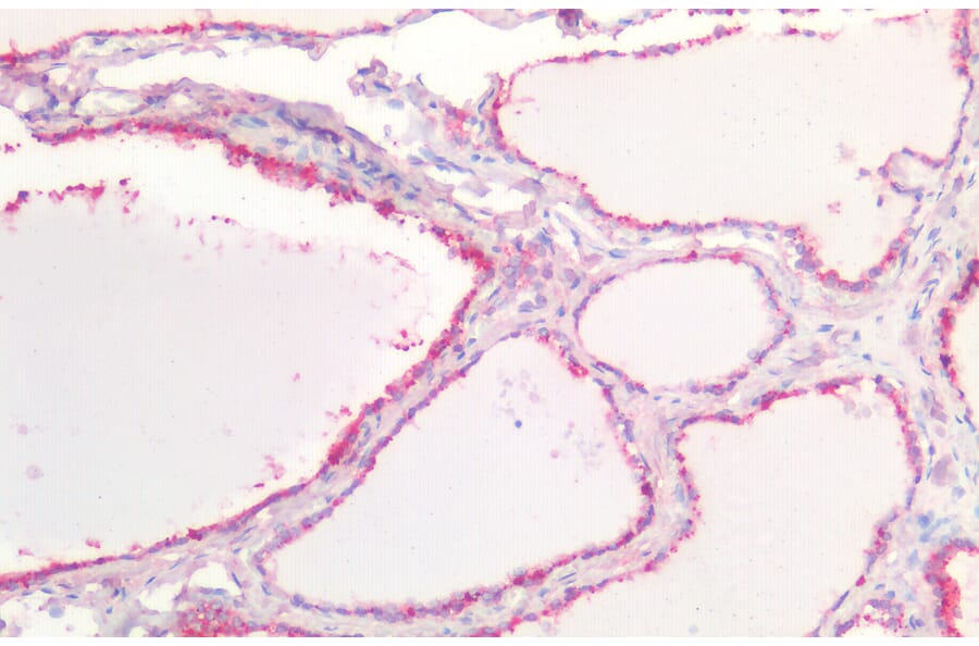Immunohistochemistry - Anti-E Cadherin Antibody (A83532) - Antibodies.com
