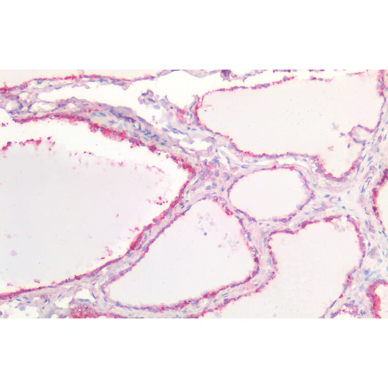 Immunohistochemistry - Anti-E Cadherin Antibody (A83532) - Antibodies.com