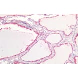 Immunohistochemistry - Anti-E Cadherin Antibody (A83532) - Antibodies.com