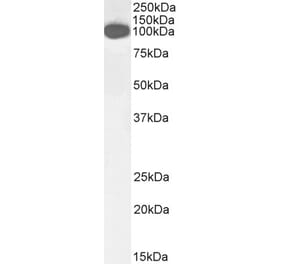 Western Blot - Anti-ICAM1 Antibody (A83533) - Antibodies.com