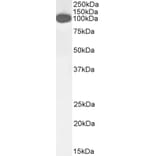 Western Blot - Anti-ICAM1 Antibody (A83533) - Antibodies.com