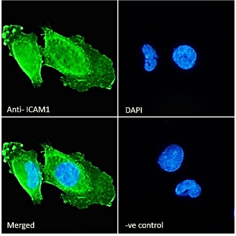 Immunofluorescence - Anti-ICAM1 Antibody (A83534) - Antibodies.com