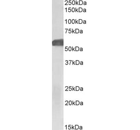 Western Blot - Anti-GLP-1R Antibody (A83537) - Antibodies.com