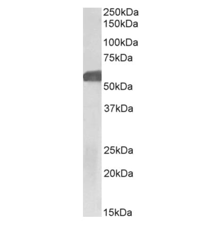 Western Blot - Anti-GLP1R Antibody (A83537) - Antibodies.com