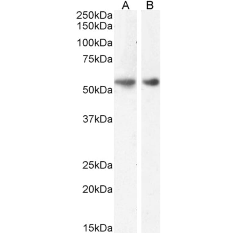Western Blot - Anti-GLP-1R Antibody (A83537) - Antibodies.com