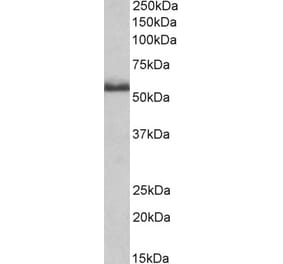 Western Blot - Anti-TNF Receptor II Antibody (A83540) - Antibodies.com