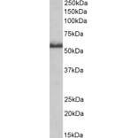 Western Blot - Anti-TNF Receptor II Antibody (A83540) - Antibodies.com