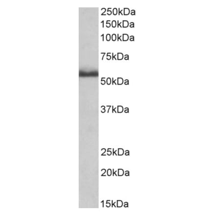 Western Blot - Anti-Tnfrsf1b Antibody (A83540) - Antibodies.com