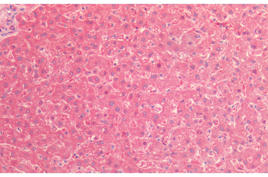 Immunohistochemistry - Anti-TNF Receptor II Antibody (A83540) - Antibodies.com