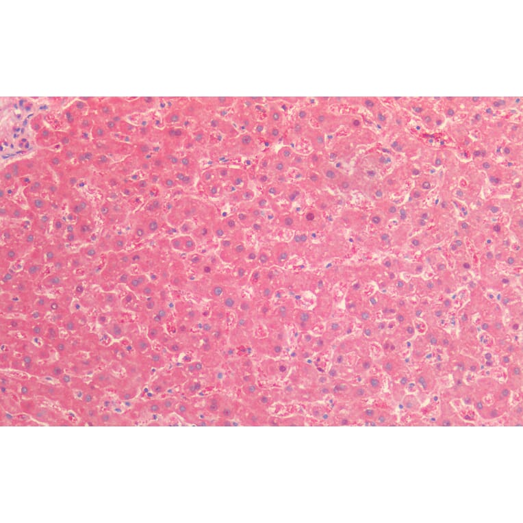 Immunohistochemistry - Anti-TNF Receptor II Antibody (A83540) - Antibodies.com