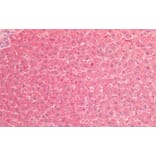 Immunohistochemistry - Anti-TNF Receptor II Antibody (A83540) - Antibodies.com