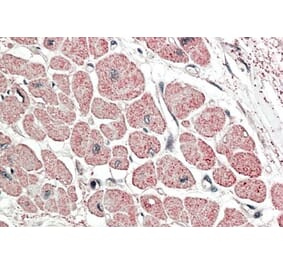 Immunohistochemistry - Anti-proANP Antibody (A83541) - Antibodies.com