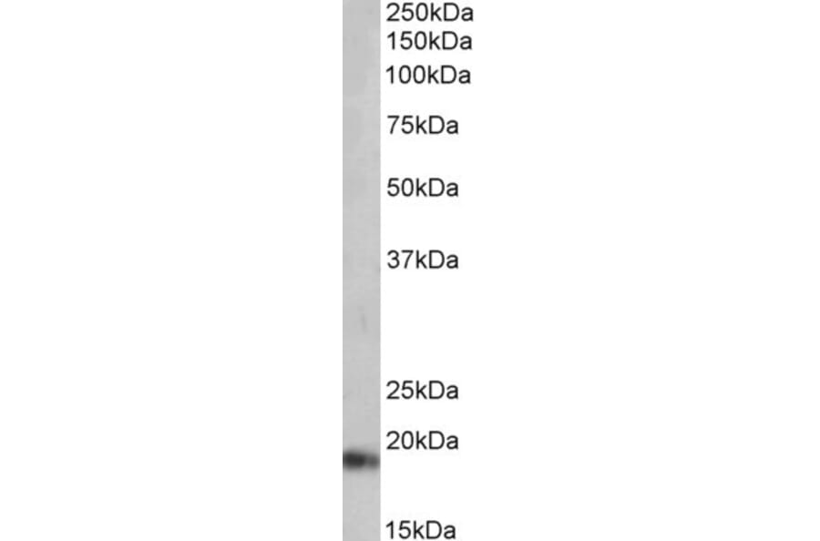 Western Blot - Anti-proANP Antibody (A83541) - Antibodies.com