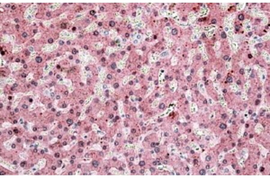 Immunohistochemistry - Anti-ITIH4 Antibody (A83542) - Antibodies.com