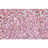 Immunohistochemistry - Anti-ITIH4 Antibody (A83542) - Antibodies.com