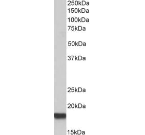 Western Blot - Anti-Fragilis Antibody (A83544) - Antibodies.com