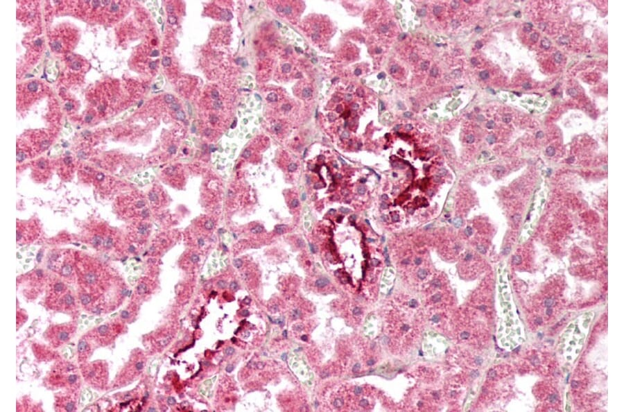 Immunohistochemistry - Anti-Fragilis Antibody (A83544) - Antibodies.com