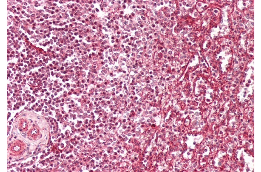 Immunohistochemistry - Anti-Fragilis Antibody (A83544) - Antibodies.com