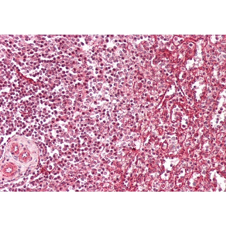 Immunohistochemistry - Anti-Fragilis Antibody (A83544) - Antibodies.com