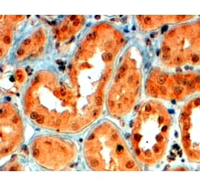 Immunohistochemistry - Anti-SEMA5A Antibody (A83545) - Antibodies.com