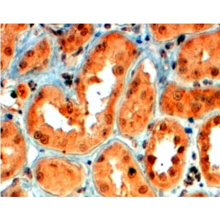 Immunohistochemistry - Anti-SEMA5A Antibody (A83545) - Antibodies.com