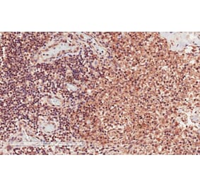 Immunohistochemistry - Anti-CD28 Antibody (A83546) - Antibodies.com