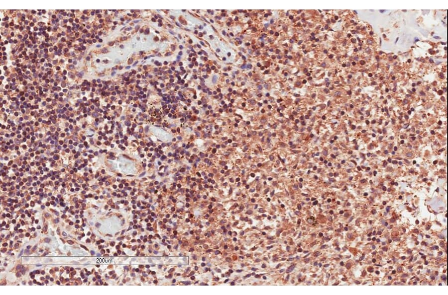 Immunohistochemistry - Anti-CD28 Antibody (A83546) - Antibodies.com