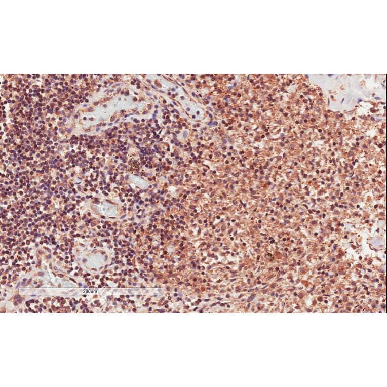Immunohistochemistry - Anti-CD28 Antibody (A83546) - Antibodies.com
