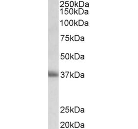 Western Blot - Anti-CD7 Antibody (A83547) - Antibodies.com