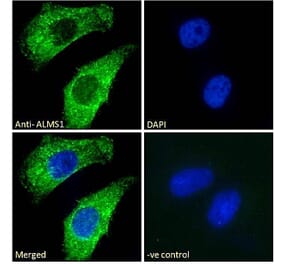 Immunofluorescence - Anti-ALMS1 Antibody (A83548) - Antibodies.com