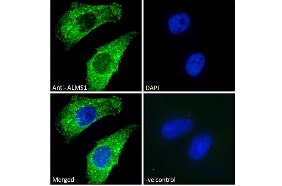 Immunofluorescence - Anti-ALMS1 Antibody (A83548) - Antibodies.com