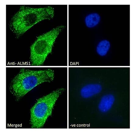 Immunofluorescence - Anti-ALMS1 Antibody (A83548) - Antibodies.com