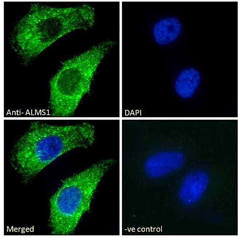 Immunofluorescence - Anti-ALMS1 Antibody (A83548) - Antibodies.com