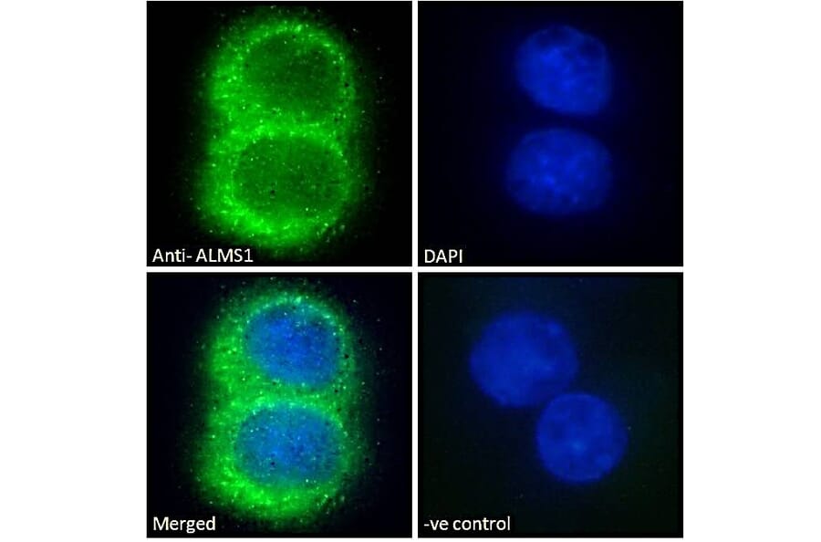 Immunofluorescence - Anti-ALMS1 Antibody (A83548) - Antibodies.com