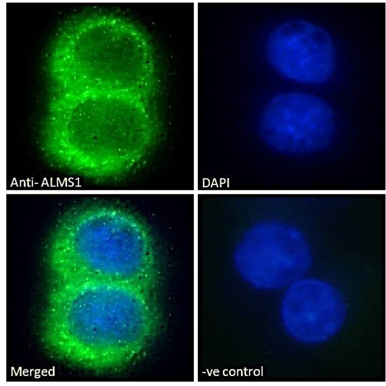 Immunofluorescence - Anti-ALMS1 Antibody (A83548) - Antibodies.com