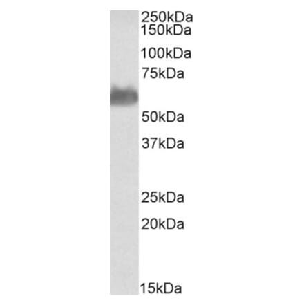 Western Blot - Anti-FTCD Antibody (A83551) - Antibodies.com